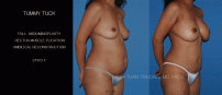 TTUCK32B