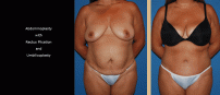 TTuck22