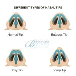 different types of nose tips