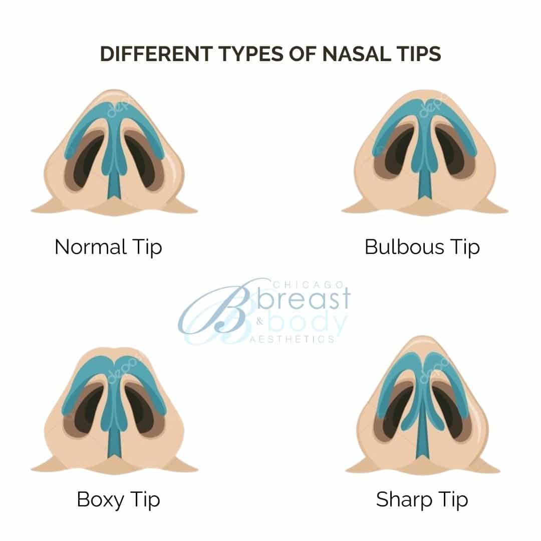 different types of nose tips