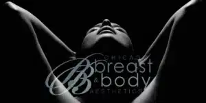 chicago breast and body before and after gallery