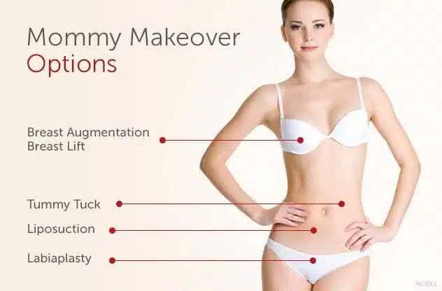 image-mommy-makeover-graphic copia