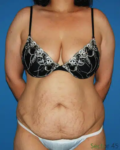 Case #28 - A woman in a bikini showcasing her breasts.