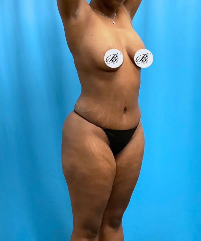 A woman wearing a bikini.