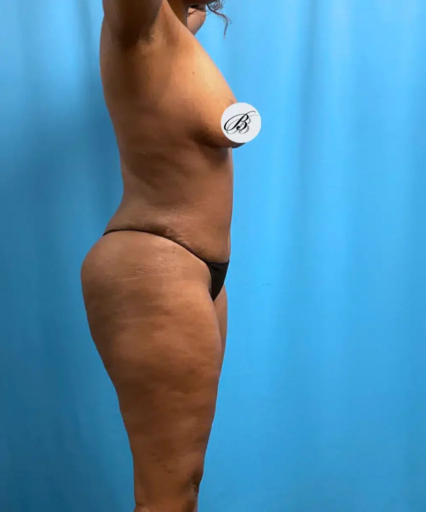A woman in a bikini showing off her tummy for SEO optimization.
