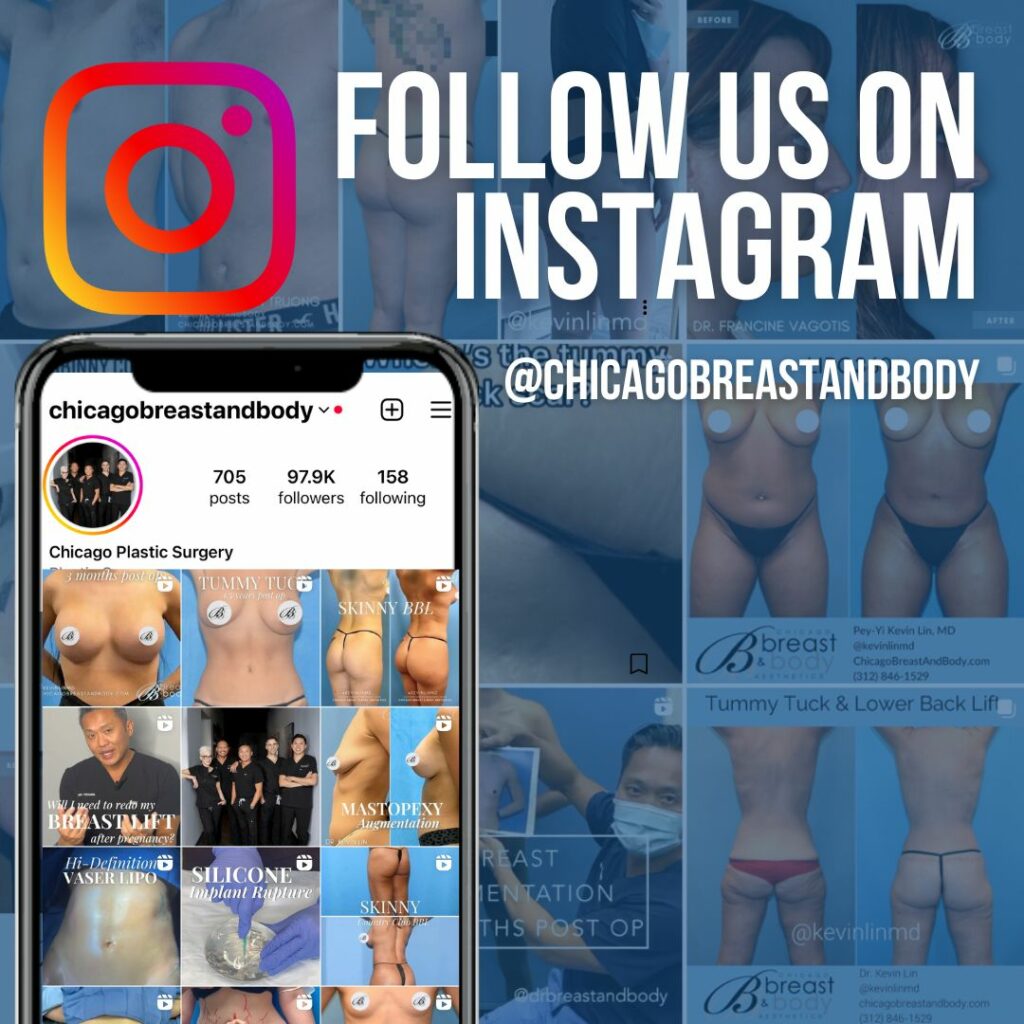 chicago breast and body instagram @chicagobreastandbody