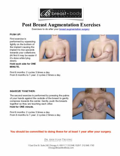 exercises to do after your breast augmentation pdf