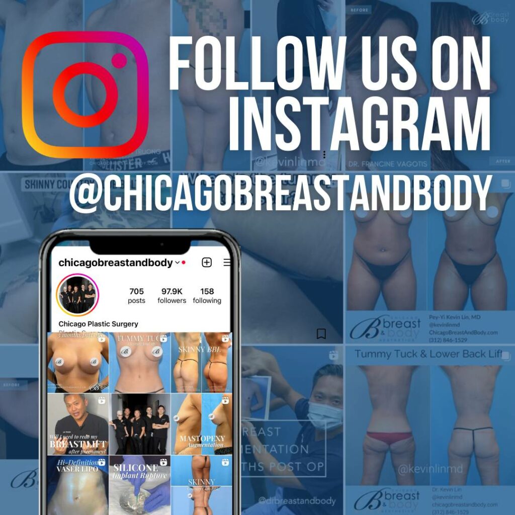 Instagram @chicagobreastandbody