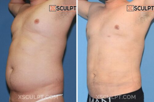 18452800 TotalSculpt Dr. Truong Chicago 1mos