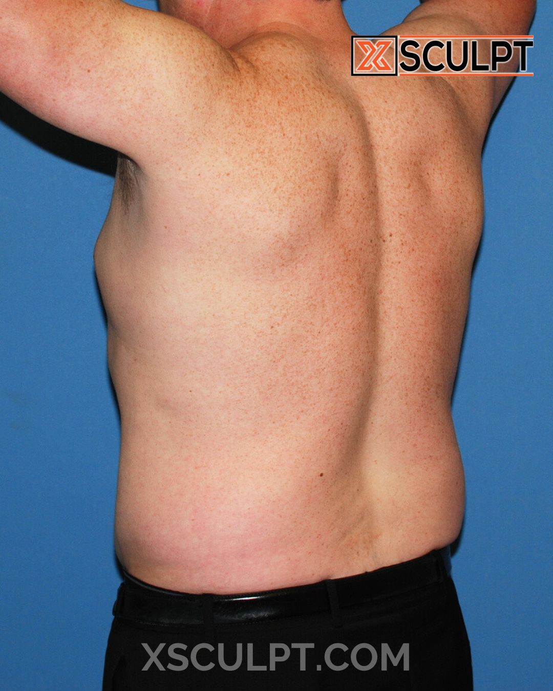 Before photo, angle 7