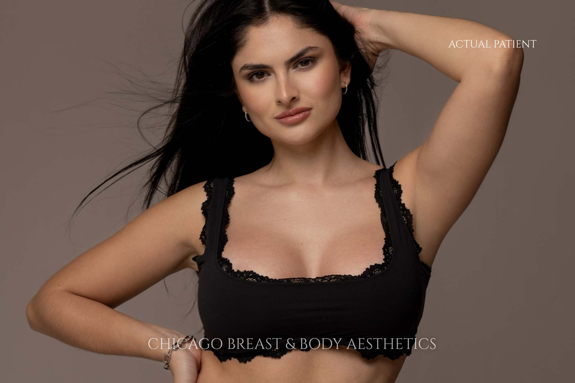 Chicago Breast &Amp; Body Aesthetics | Chicago Breast And Body Aesthetics picture showing actual patient at chicago breast and body after breast augmenation