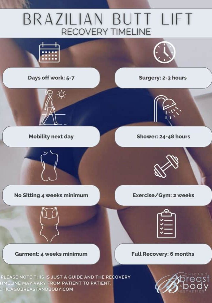 BBL Brazilian Butt Lift Recovery Timeline Chicago Breast & Body Aesthetics